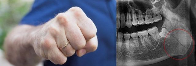 В Мегино-Кангаласском районе возбуждено уголовное дело в отношении депутата