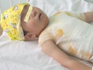 Мама мальчика, которого подожгли на детской площадке: "Я пойду до конца!"