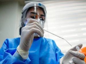 Срок действия ПЦР-тестов в России сократят с 72 до 48 часов