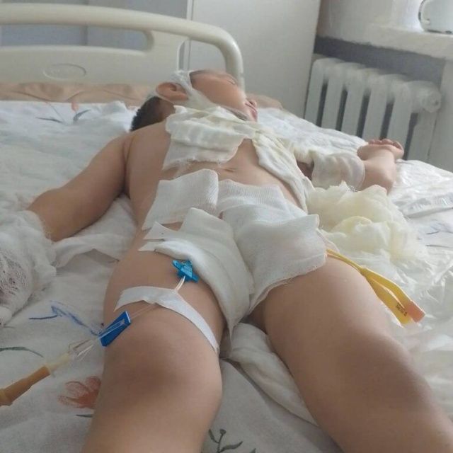 Маленькому Марку назначена операция