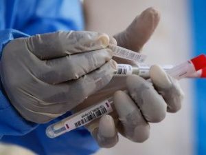 В Якутии за сутки выявлено 190 новых случаев коронавирусной инфекции