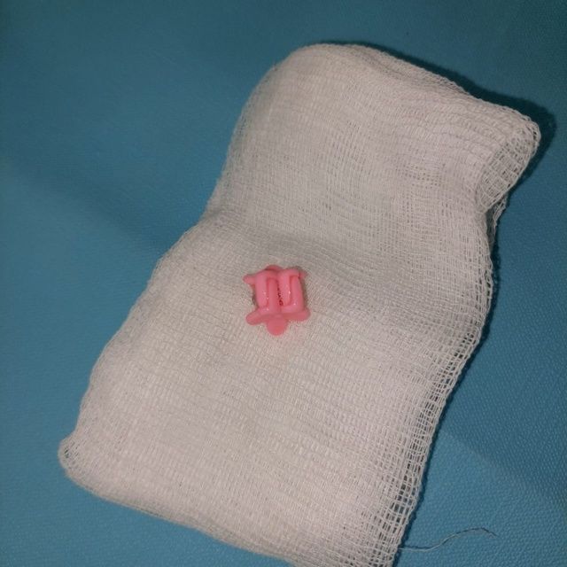 В Якутии четырехлетний ребенок поперхнулся заколкой для волос