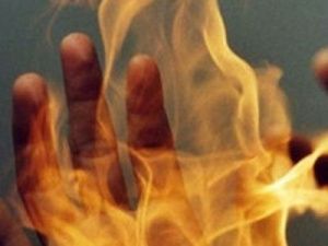 В Якутии мужчина после ссоры облил приятеля горючей жидкостью и поджег