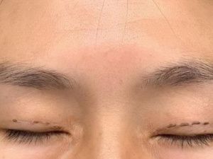 Ужас: Жительница улуса стала жертвой операции сангапури