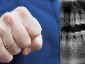 В Мегино-Кангаласском районе возбуждено уголовное дело в отношении депутата