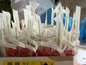 В Якутске у женщины, прилетевшей из Нидерландов, выявили подозрение на коронавирус