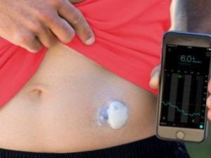 В Якутии внедряют систему непрерывного мониторинга глюкозы у пациентов с сахарным диабетом