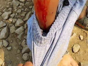 Оштрафовали хозяина собак, которые покусали ребенка на Птицефабрике