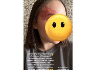 В Якутии два случая жестокого избиения женщин — полиция выясняет обстоятельства