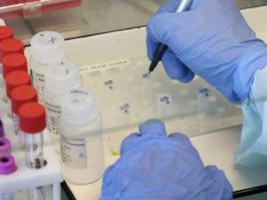 55 жителей Намского района лечатся от коронавируса