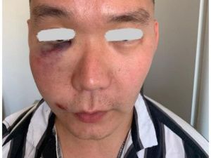 Избитый узнал в нападавшем известного якутского певца — Телеграм