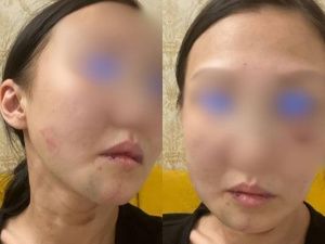 Жуткая история: И врагу не пожелаешь!